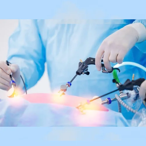 Laparoscopic Surgery